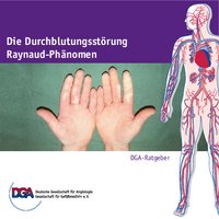 DGA Ratgeber: Die Durchblutungsstörung - Raynaud Phänomen